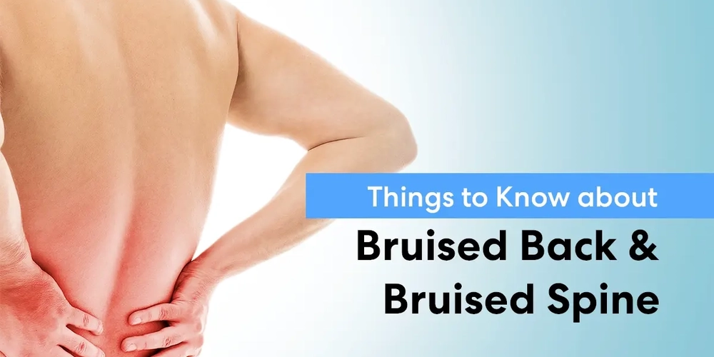 Things to Know About Bruised Back & Bruised Spine